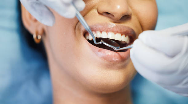 Best Broken or Chipped Tooth Repair in Phenix City, AL